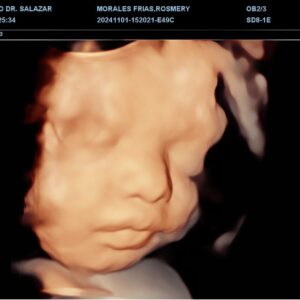 ECOGRAFÍA MORFOLOGICA